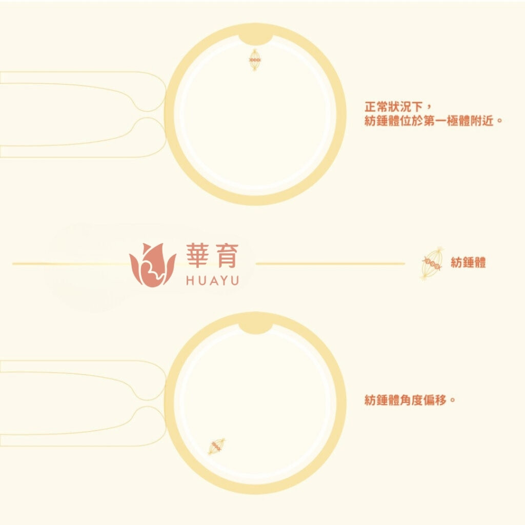 第一極體